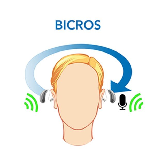 Silicio Canoa Rama Audífonos para oídos inaudibles – ▷ Balneario Visión – Óptica en Arteixo